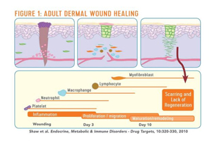Figure About Dermal Wound Healing